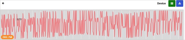 Graph of body electrical waves